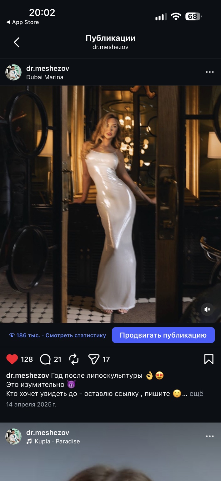 Липоскульптура тела, фотография 1