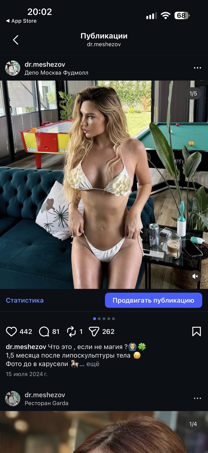Липоскульптура тела, фотография 1